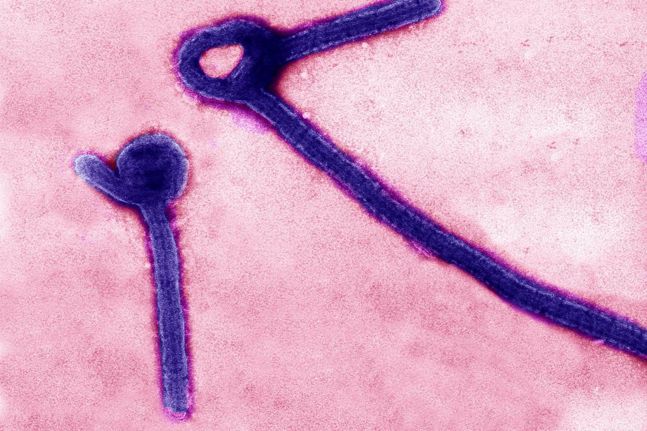 virus, ebola