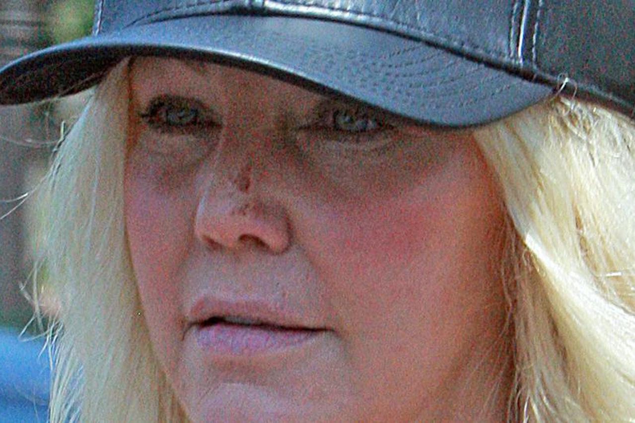 Izgrebana je i podbuhla