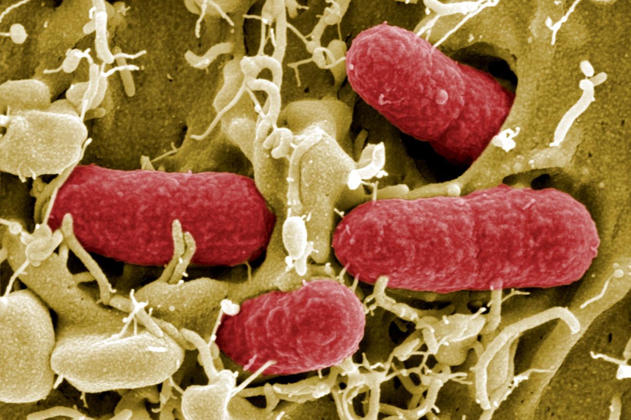 e coli, bakterija (1)