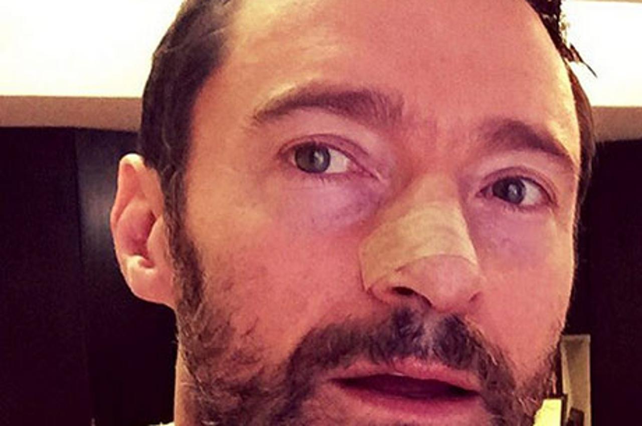Hugh Jackman