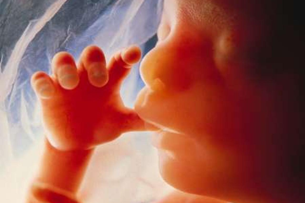 'fetus'