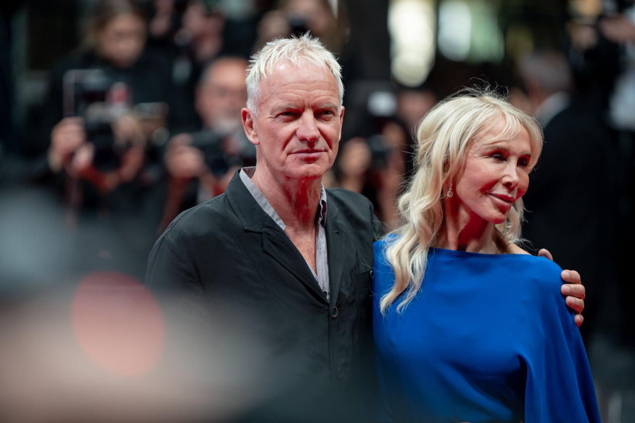 Sting