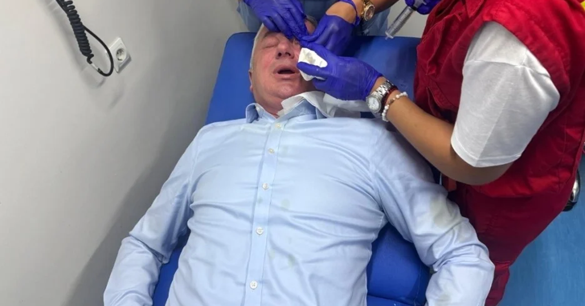 Borenović napadnut u Banja Luci, maskirani muškarci ga poprskala sprejem Borenović napadnut u Banja Luci, maskirani muškarci ga poprskala sprejem