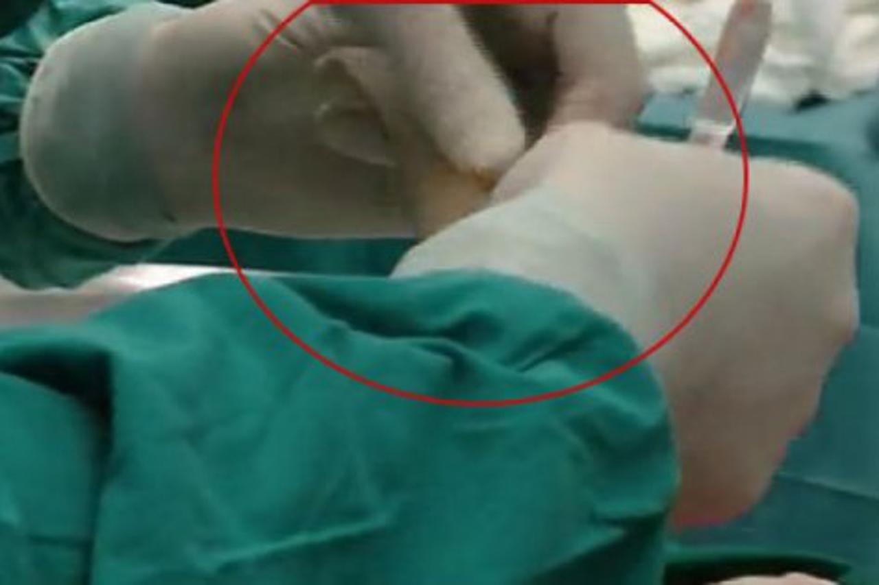 Prvi put u Hrvatskoj: