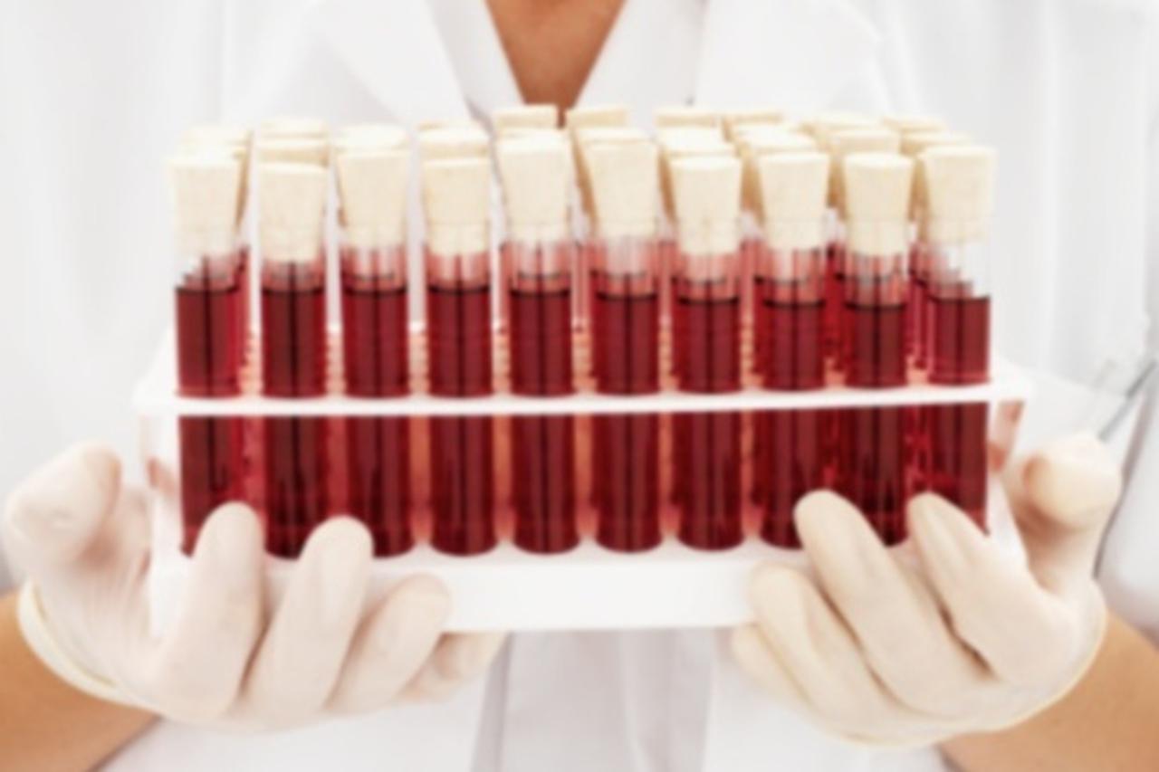 Banka koštane srži