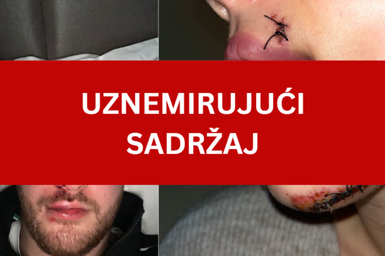 Hrvati napadnuti u Beogradu