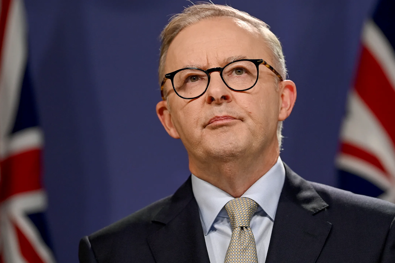 Anthony Albanese