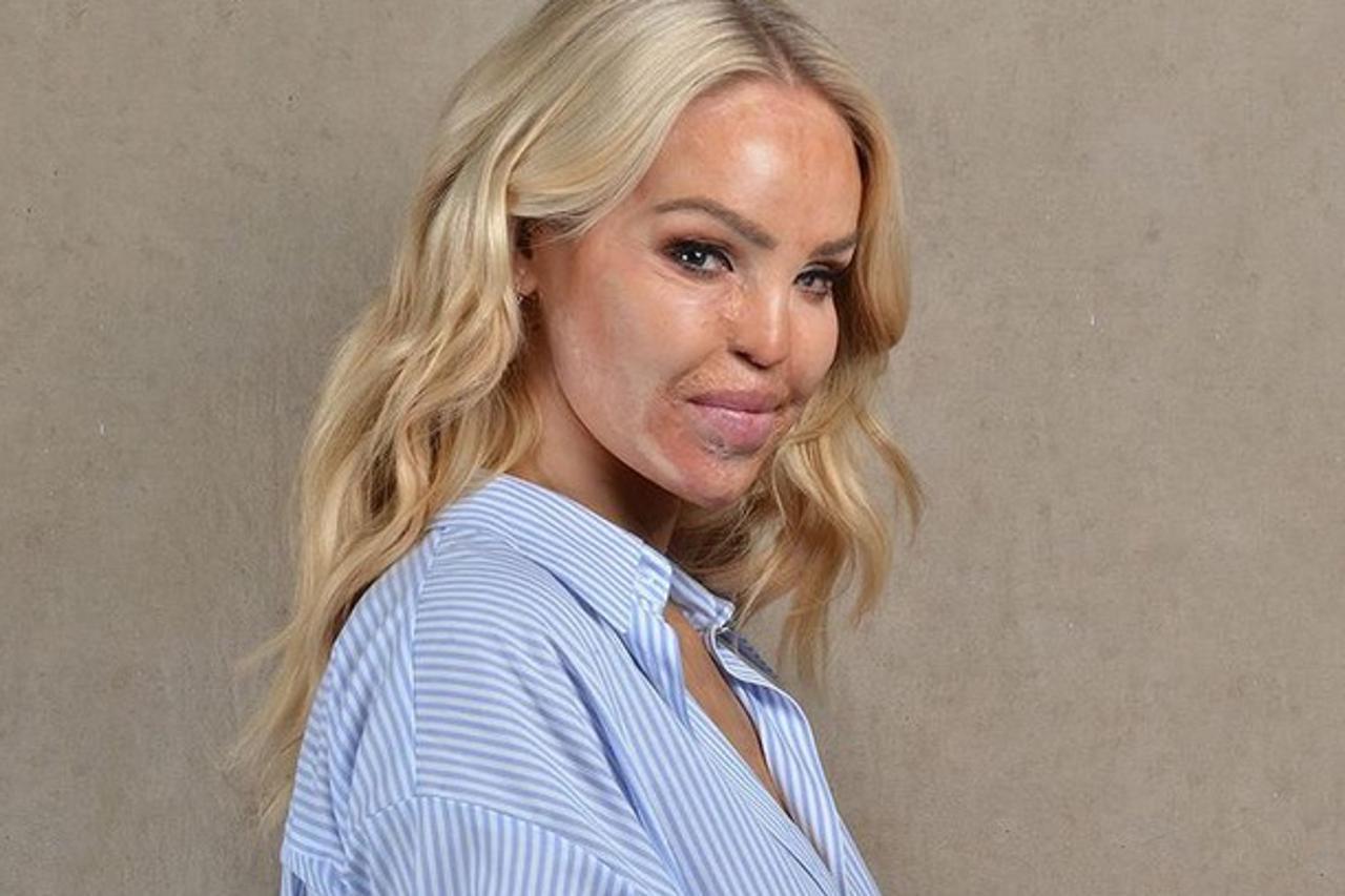 Katie Piper