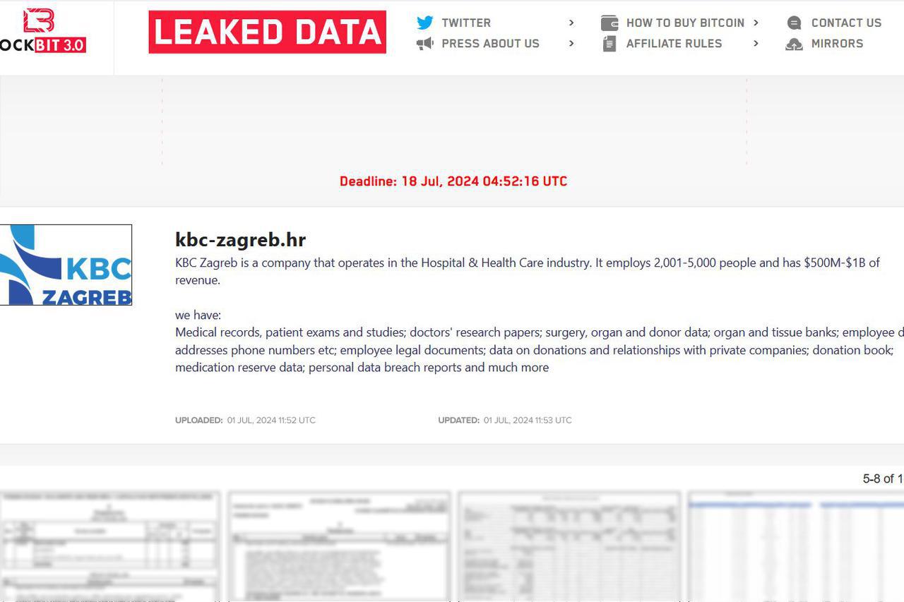 hakerski napad - KBC Zagreb