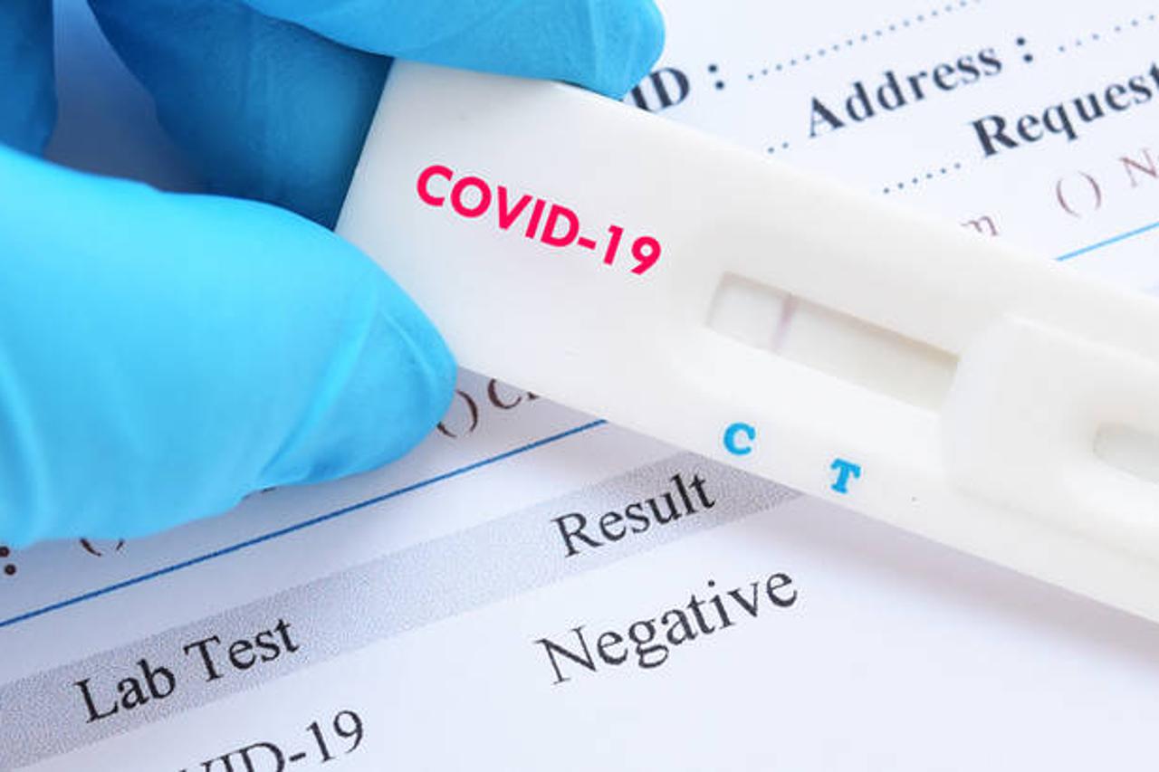 koronavirus - test